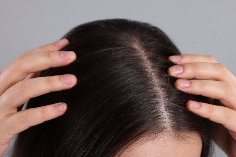 Scalp Care as the New Skincare: Treatments for a Healthy Foundation